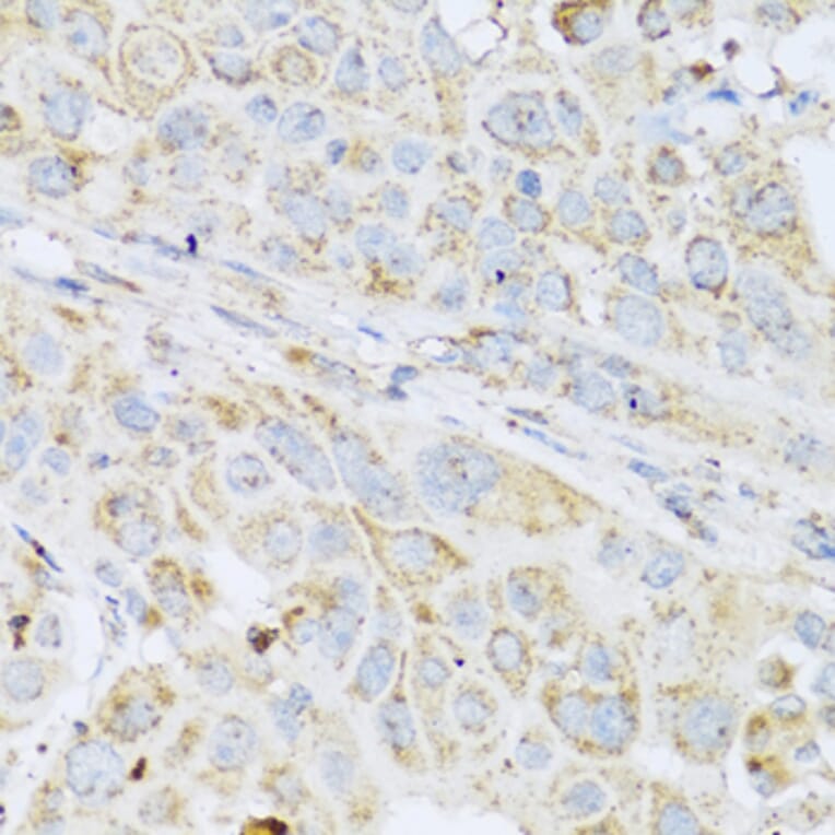 Immunohistochemistry - Anti-LYZ Antibody (A2503) - Antibodies.com