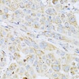 Immunohistochemistry - Anti-LYZ Antibody (A2503) - Antibodies.com