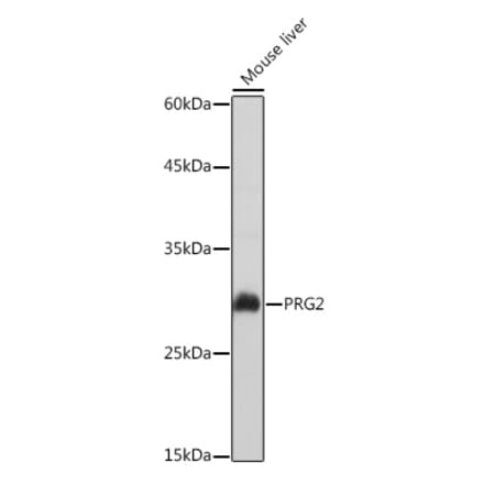 Western Blot - Anti-PRG2 Antibody (A11539) - Antibodies.com
