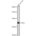 Western Blot - Anti-PRG2 Antibody (A11539) - Antibodies.com