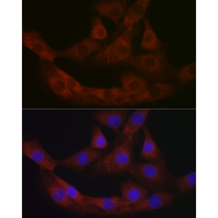 Immunofluorescence - Anti-PRG2 Antibody (A11539) - Antibodies.com