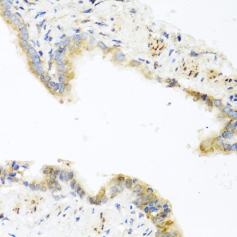 Immunohistochemistry - Anti-RETN Antibody (A2551) - Antibodies.com
