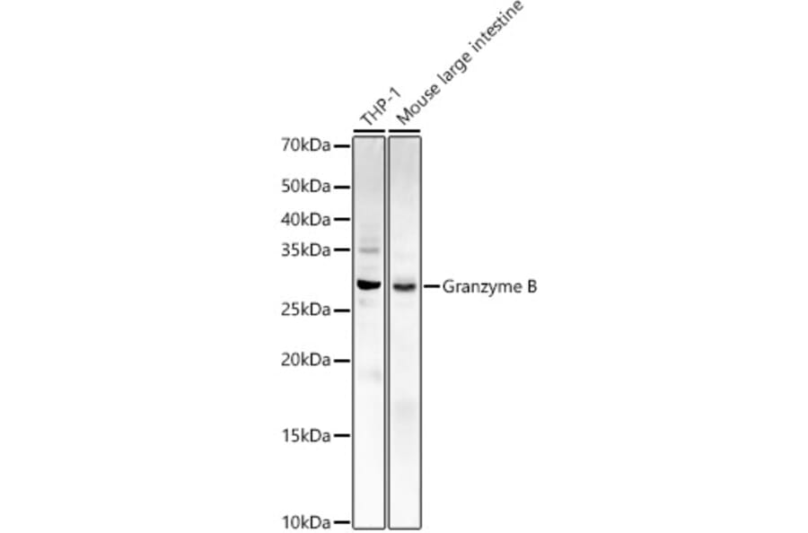 Western Blot - Anti-Granzyme B Antibody (A11541) - Antibodies.com