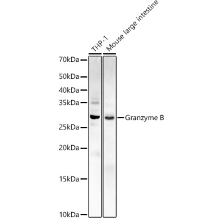 Western Blot - Anti-Granzyme B Antibody (A11541) - Antibodies.com