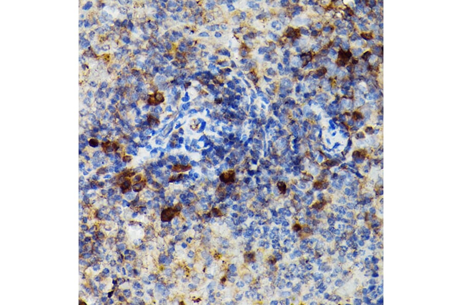 Immunohistochemistry - Anti-Granzyme B Antibody (A11541) - Antibodies.com
