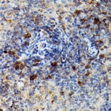 Immunohistochemistry - Anti-Granzyme B Antibody (A11541) - Antibodies.com