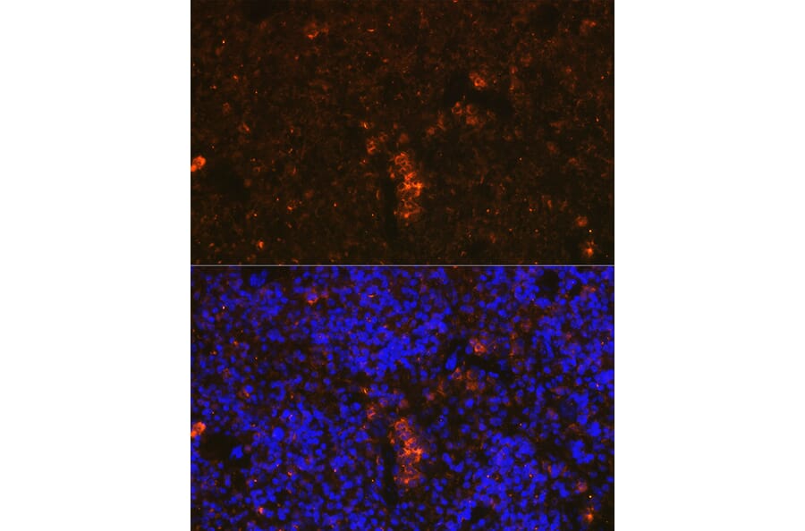 Immunofluorescence - Anti-Granzyme B Antibody (A11541) - Antibodies.com