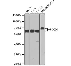 Western Blot - Anti-PDCD4 Antibody (A11542) - Antibodies.com
