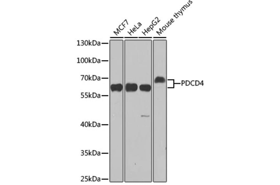 Western Blot - Anti-PDCD4 Antibody (A11542) - Antibodies.com