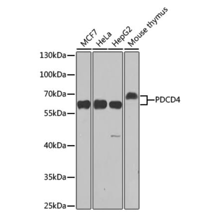 Western Blot - Anti-PDCD4 Antibody (A11542) - Antibodies.com