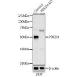 Western Blot - Anti-PDCD4 Antibody (A11542) - Antibodies.com