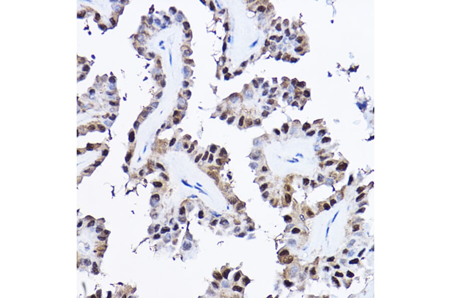 Immunohistochemistry - Anti-PDCD4 Antibody (A11542) - Antibodies.com