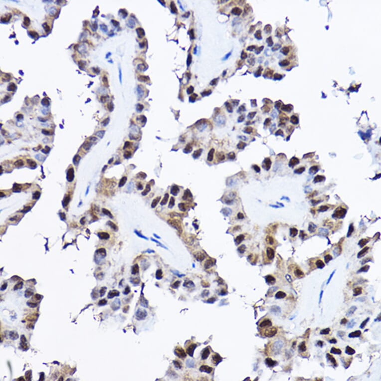 Immunohistochemistry - Anti-PDCD4 Antibody (A11542) - Antibodies.com