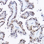 Immunohistochemistry - Anti-PDCD4 Antibody (A11542) - Antibodies.com