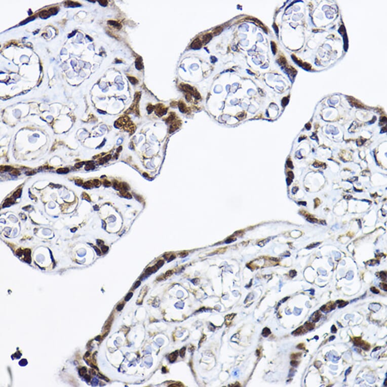 Immunohistochemistry - Anti-PDCD4 Antibody (A11542) - Antibodies.com