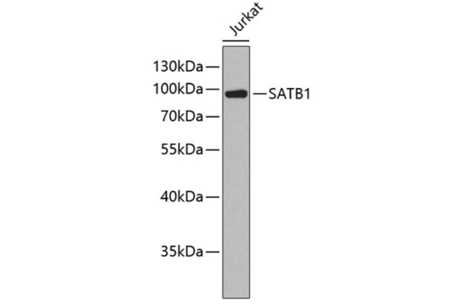 Western Blot - Anti-SATB1 Antibody (A2602) - Antibodies.com