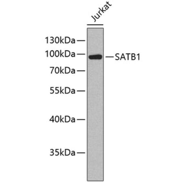 Western Blot - Anti-SATB1 Antibody (A2602) - Antibodies.com