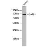 Western Blot - Anti-SATB1 Antibody (A2602) - Antibodies.com