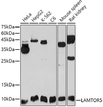 Western blot analysis of extracts of various cell lines, using Anti-LAMTOR5 Antibody (A2606) at 1:1,000 dilution.
Secondary antibody: Goat Anti-Rabbit IgG (H+L) (HRP) (AS014) at 1:10,000 dilution.
Lysates / proteins: 25µg per lane.
Blocking buffer: 3% non-fat dry milk in TBST.
Detection: ECL Enhanced Kit (RM00021).
Exposure time: 10s.
