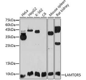 Western Blot - Anti-HBXIP Antibody (A11544) - Antibodies.com