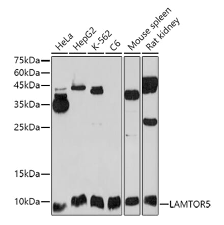 Western Blot - Anti-HBXIP Antibody (A11544) - Antibodies.com