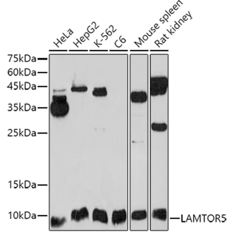 Western Blot - Anti-HBXIP Antibody (A11544) - Antibodies.com