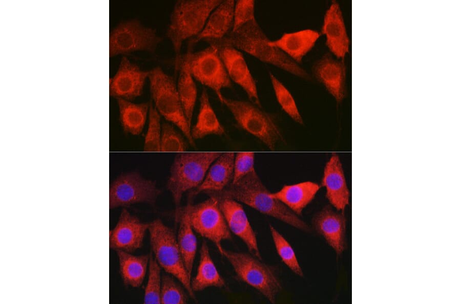 Immunofluorescence - Anti-HBXIP Antibody (A11544) - Antibodies.com
