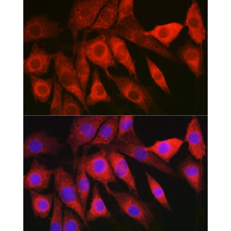 Immunofluorescence - Anti-HBXIP Antibody (A11544) - Antibodies.com