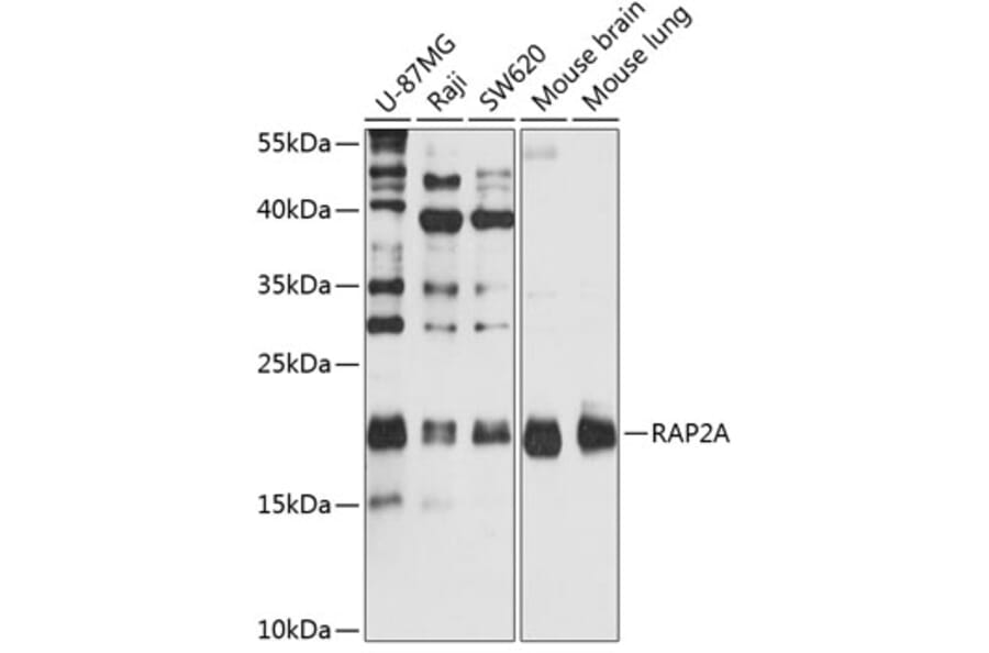 Western Blot - Anti-RAP2A Antibody (A2616) - Antibodies.com