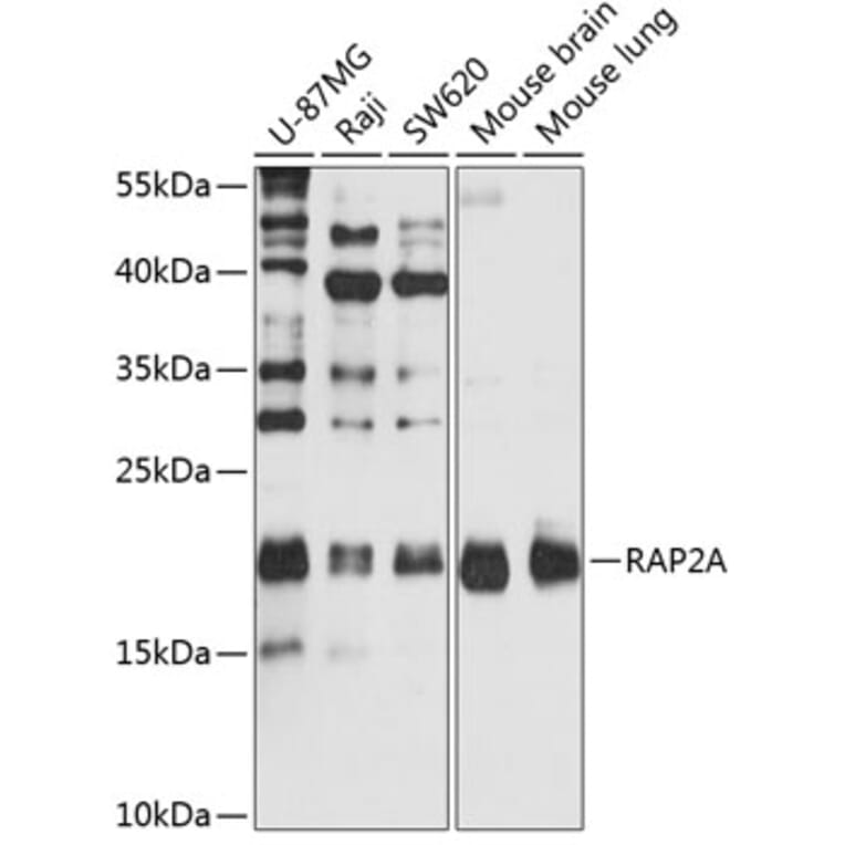 Western Blot - Anti-RAP2A Antibody (A2616) - Antibodies.com
