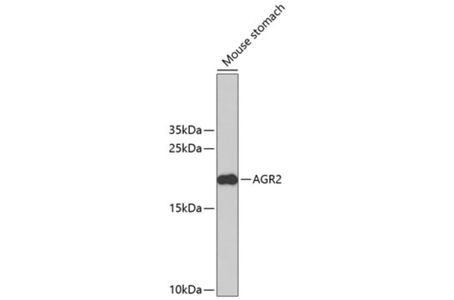 Western Blot - Anti-AGR2 Antibody (A2632) - Antibodies.com