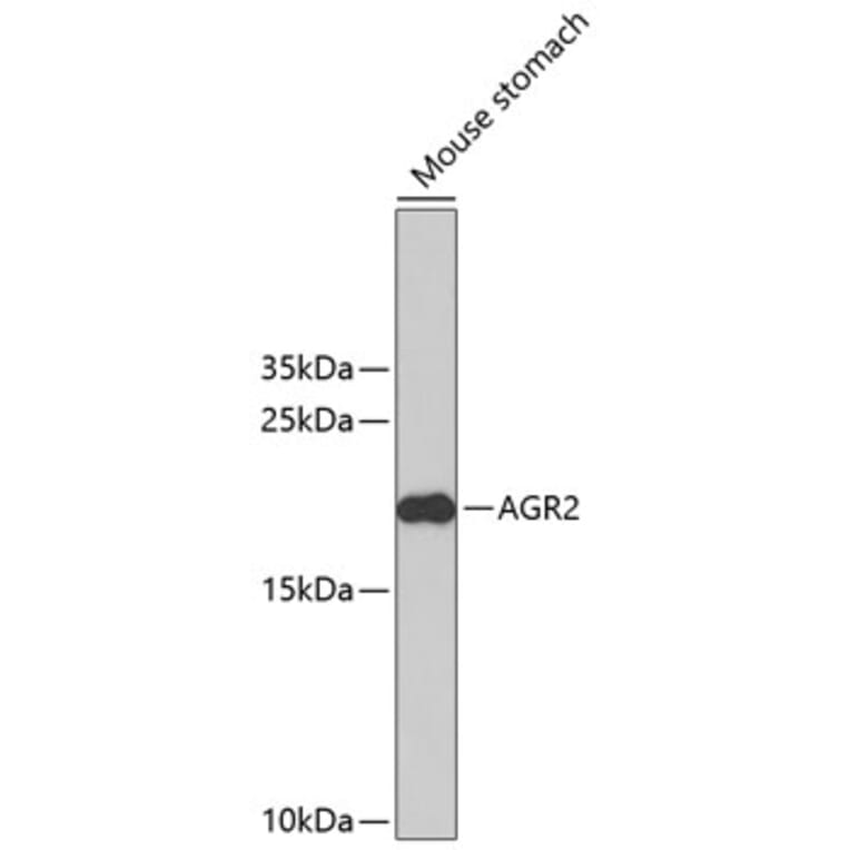 Western Blot - Anti-AGR2 Antibody (A2632) - Antibodies.com