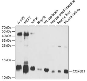 Western Blot - Anti-COX6B1 Antibody (A11547) - Antibodies.com