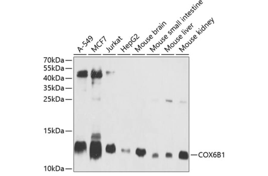Western Blot - Anti-COX6B1 Antibody (A11547) - Antibodies.com