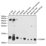 Western Blot - Anti-COX6B1 Antibody (A11547) - Antibodies.com