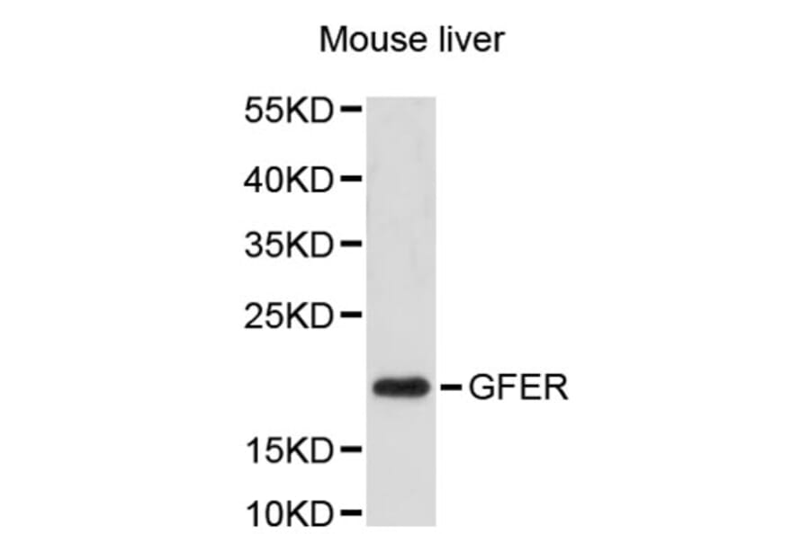 Western Blot - Anti-GFER Antibody (A2656) - Antibodies.com