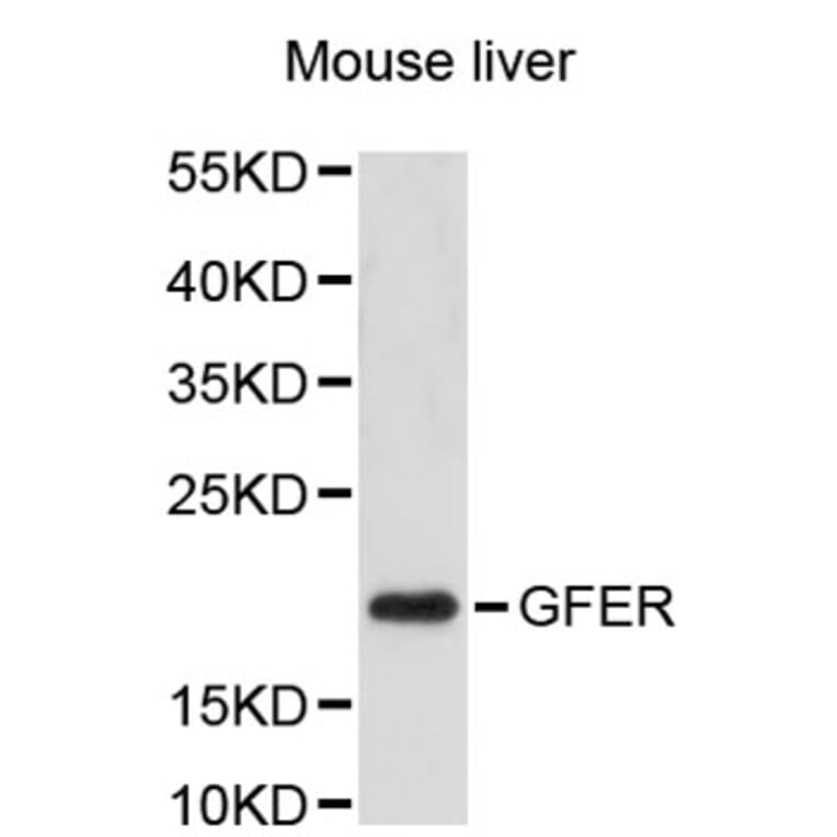 Western Blot - Anti-GFER Antibody (A2656) - Antibodies.com