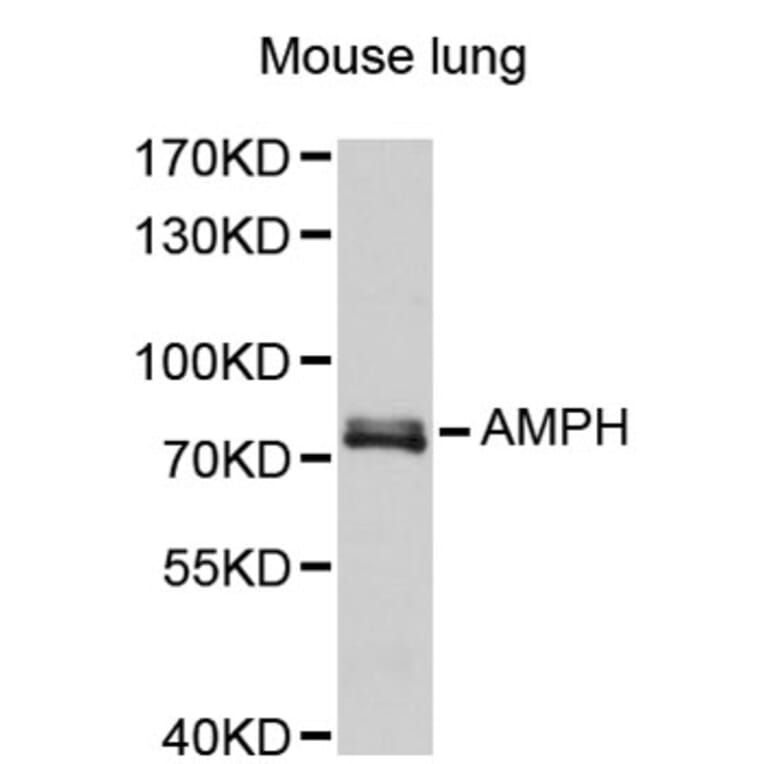 Western Blot - Anti-AMPH Antibody (A2657) - Antibodies.com