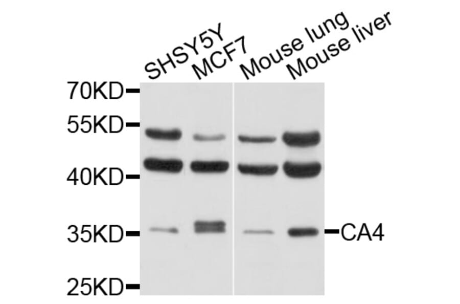 Western Blot - Anti-CA4 Antibody (A2677) - Antibodies.com