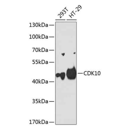 Western Blot - Anti-CDK10 Antibody (A11551) - Antibodies.com