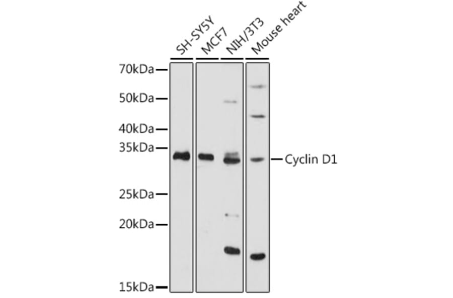 Western Blot - Anti-Cyclin D1 Antibody (A11552) - Antibodies.com