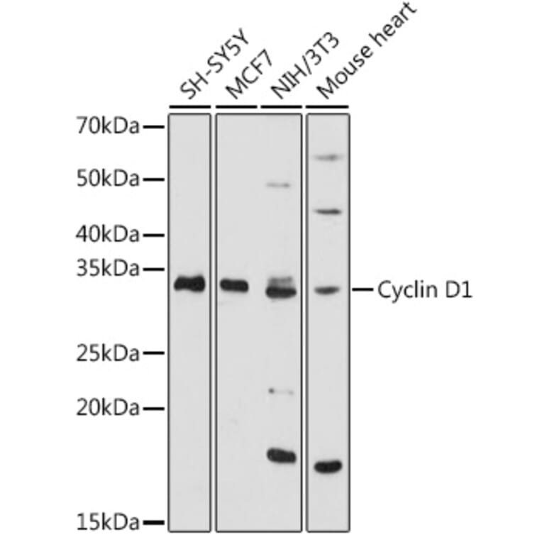 Western Blot - Anti-Cyclin D1 Antibody (A11552) - Antibodies.com