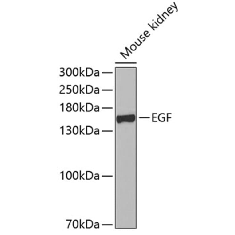 Western Blot - Anti-EGF Antibody (A11553) - Antibodies.com