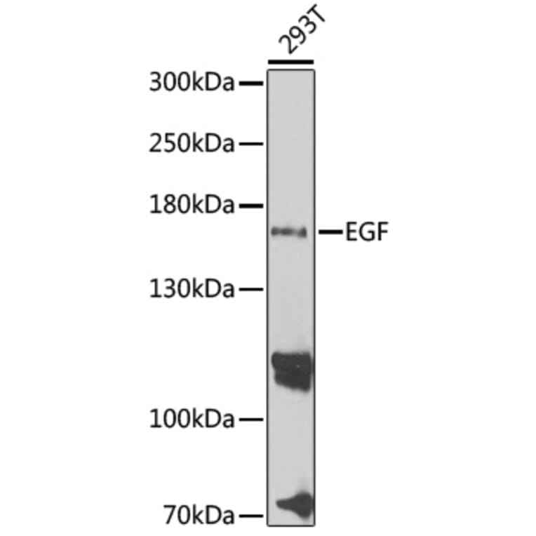 Western Blot - Anti-EGF Antibody (A11553) - Antibodies.com