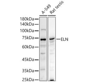 Western Blot - Anti-Elastin Antibody (A11554) - Antibodies.com