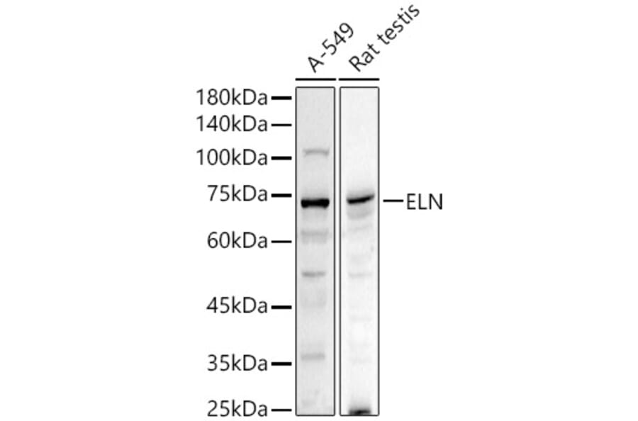 Western Blot - Anti-Elastin Antibody (A11554) - Antibodies.com