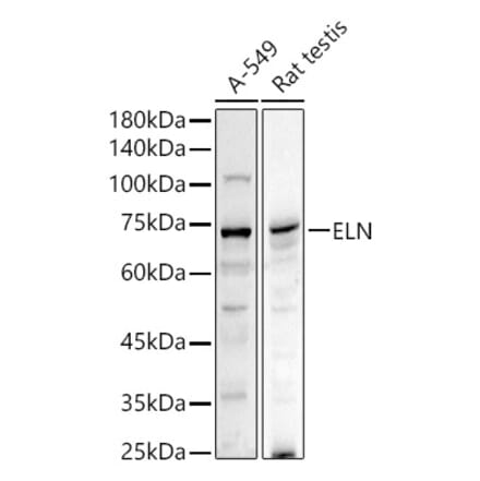 Western Blot - Anti-Elastin Antibody (A11554) - Antibodies.com