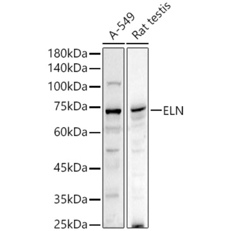 Western Blot - Anti-Elastin Antibody (A11554) - Antibodies.com