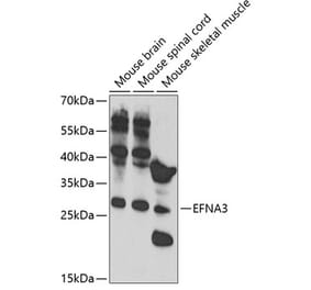 Western Blot - Anti-Ephrin A3 Antibody (A11555) - Antibodies.com
