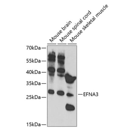 Western Blot - Anti-Ephrin A3 Antibody (A11555) - Antibodies.com